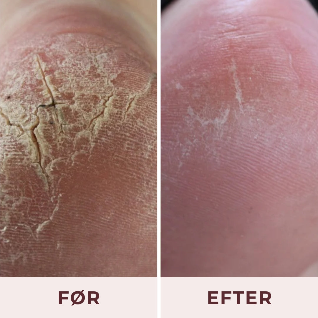 Pudderdåserne All-in-one foot cream 100 ml