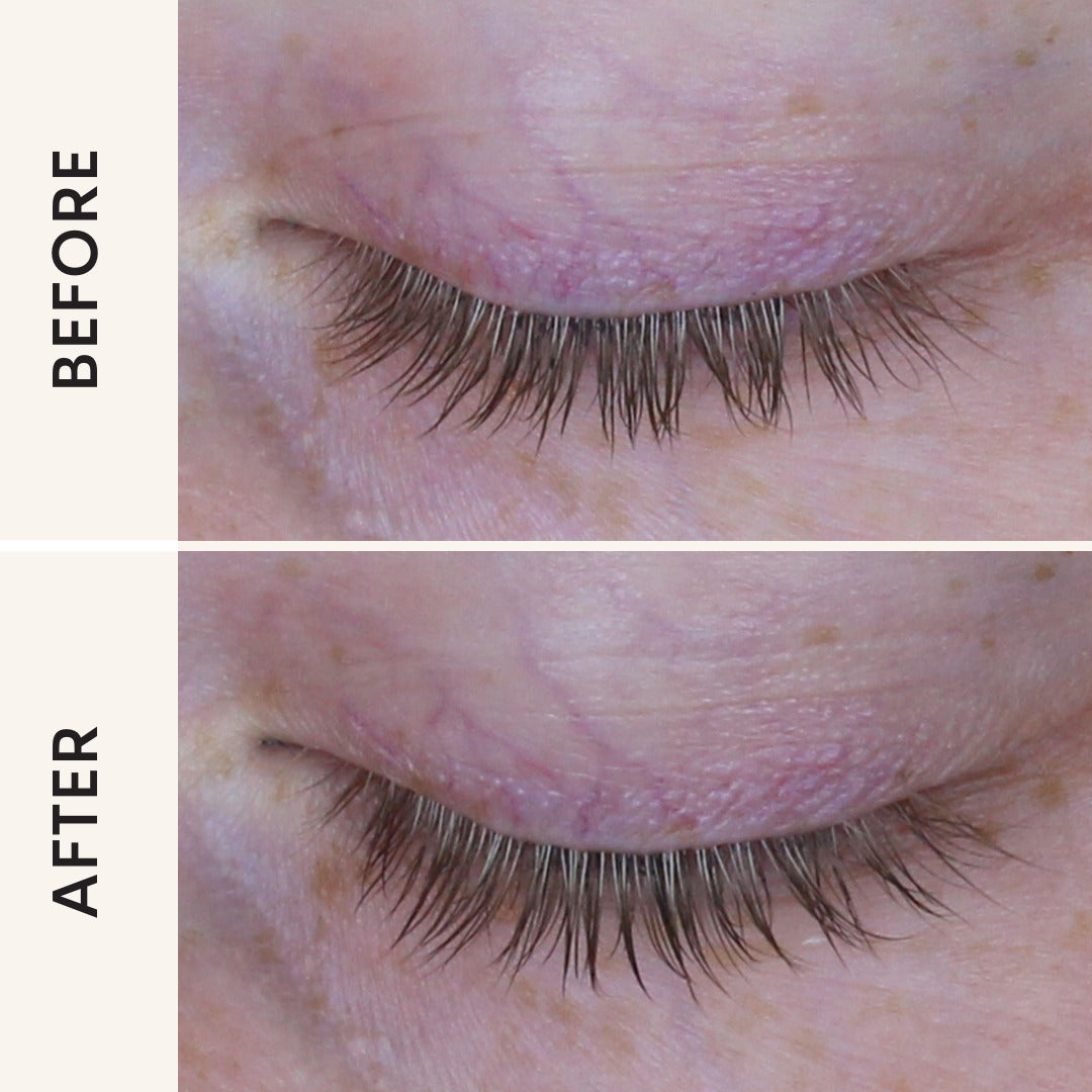 Pro Growth Serum