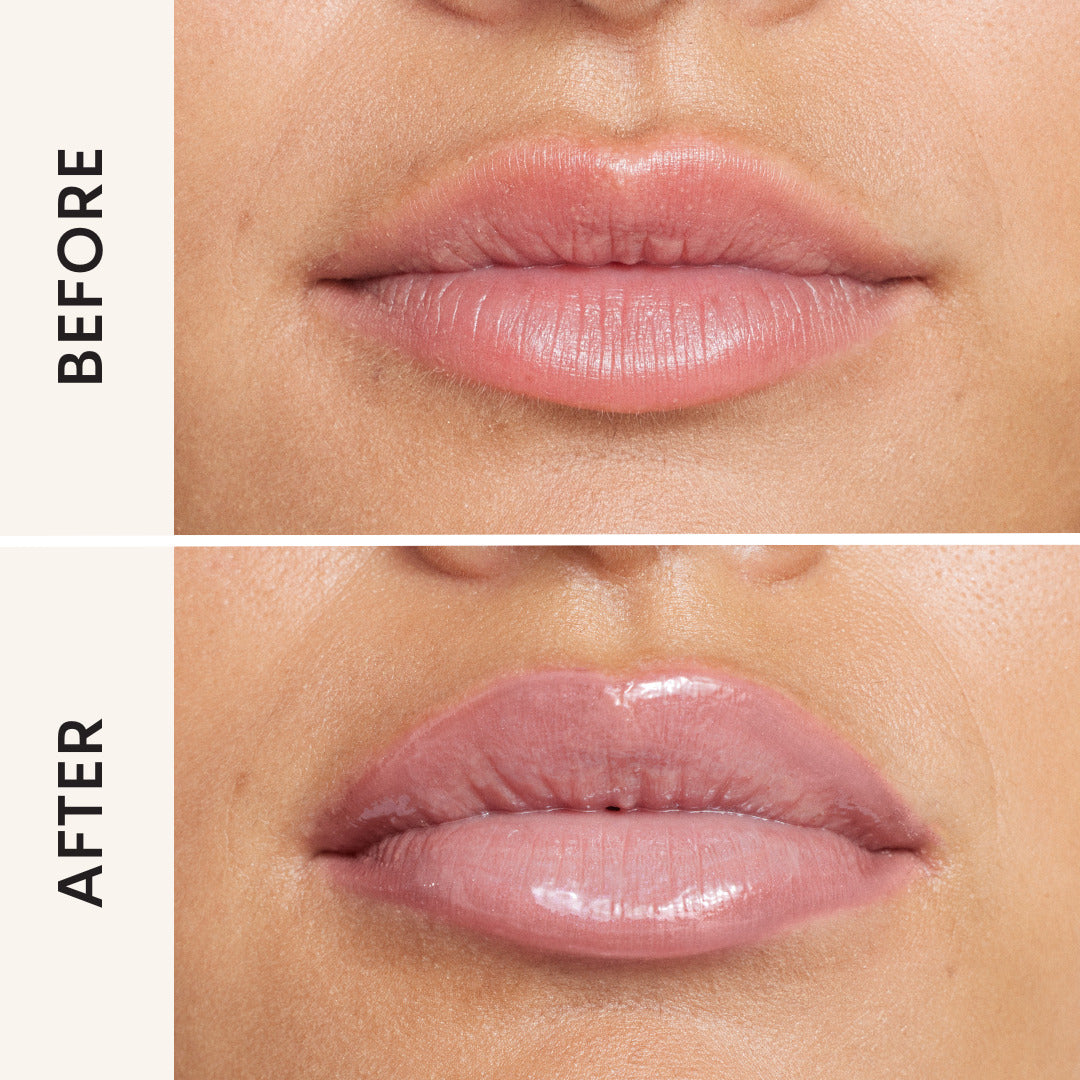 Lip Filler - 002 Ice